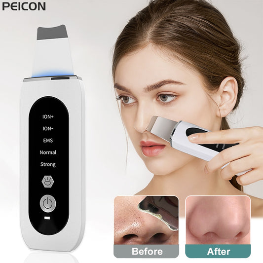 Ultrasonic Skin Ance Pore Cleaner +Deep Face Cleaning